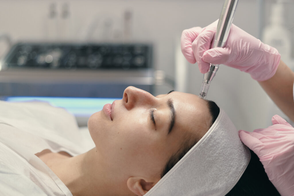 A beautician wearing pink gloves performs a microneedling facial treatment on a client lying with eyes closed and a headband.